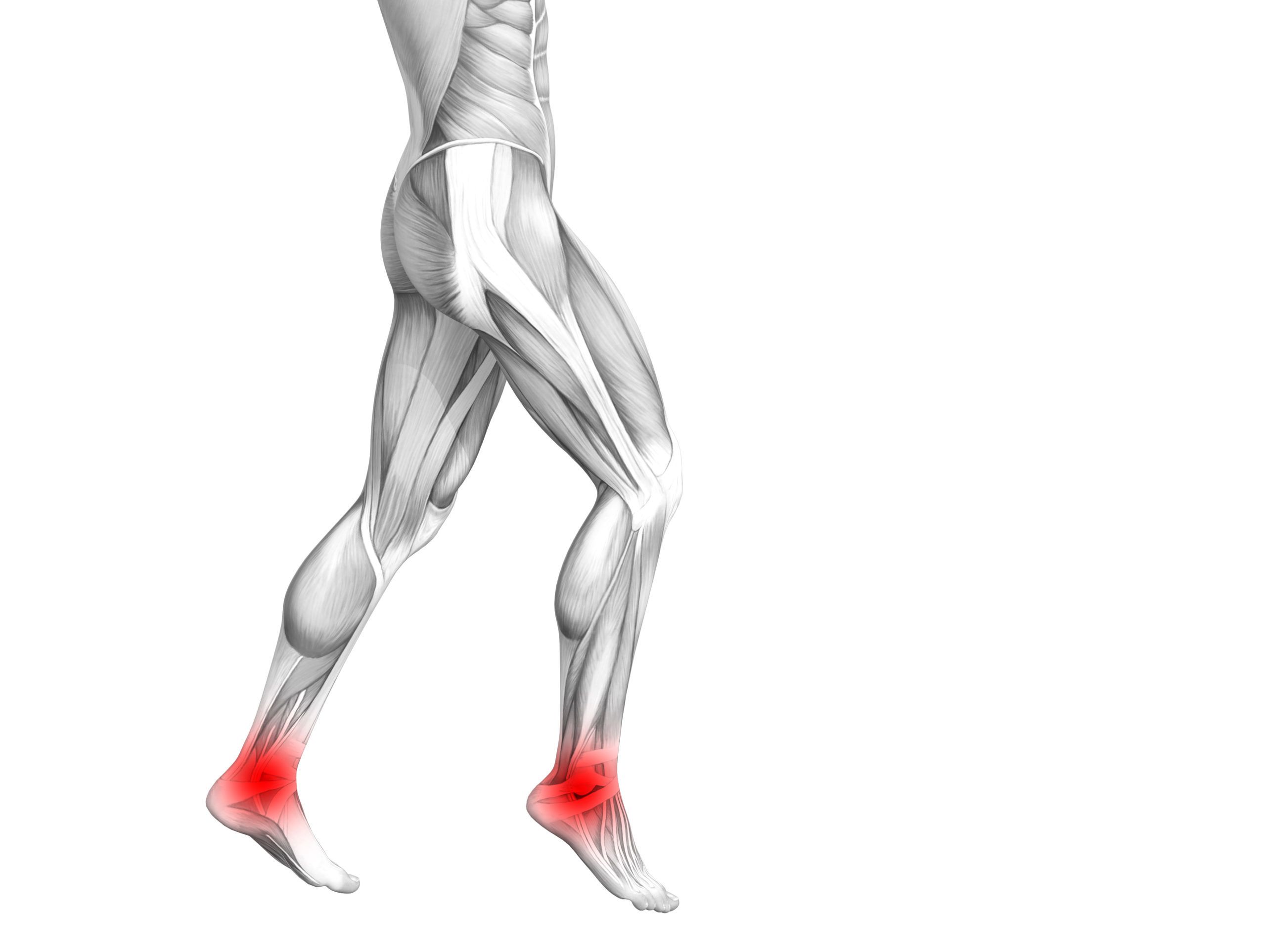 Illustration of muscle strain in ankles