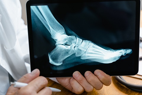 person holding an xray of a foot in a podiatry practice in chicago