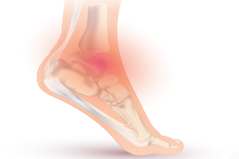 https://drschoene.com/wp-content/uploads/2023/10/ankle-sprian-treatment-and-recovery-in-chicago-il.jpg